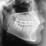 Radiologia Odontológica em Balneário Camboriú